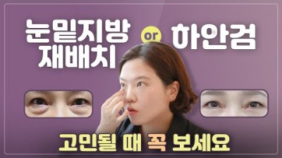 눈밑지방재배치 미니하안검 수술
